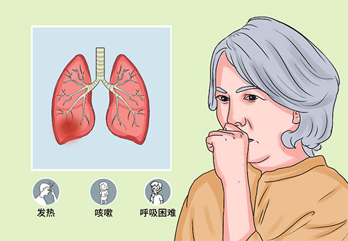 黎同明教授谈急性支气管炎的自我调养